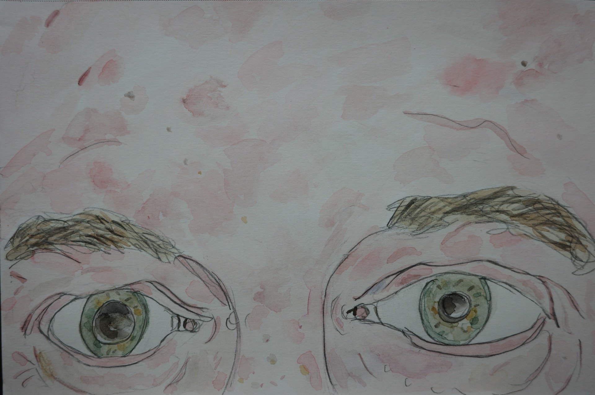 Dilated